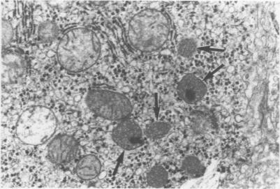 https://cdn.ncbi.nlm.nih.gov/pmc/blobs/a757/1061072/97745250e151/archdischfn00036-0058-a.jpg