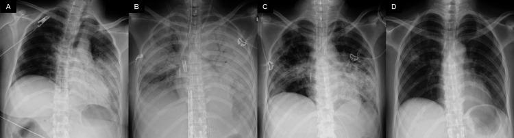 https://cdn.ncbi.nlm.nih.gov/pmc/blobs/a75c/11521961/fe36de5e3590/cureus-0016-00000070463-i04.jpg