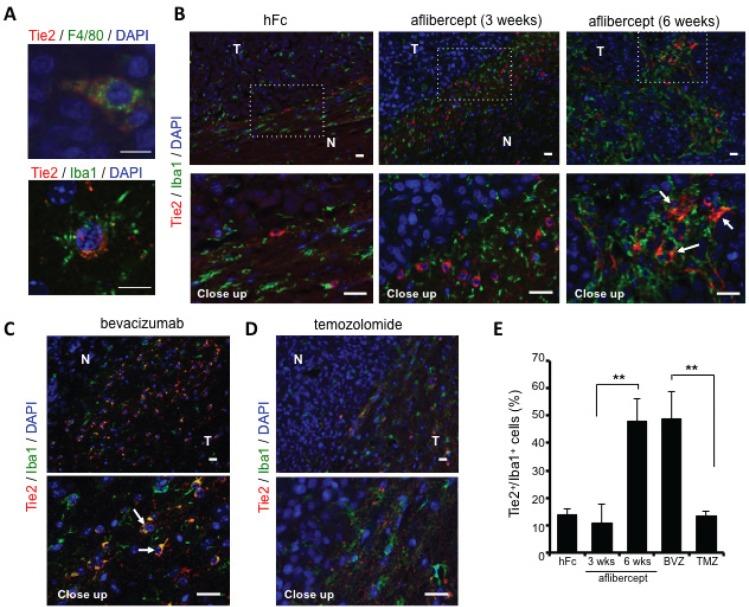 https://cdn.ncbi.nlm.nih.gov/pmc/blobs/a75d/4039157/ac746c719097/oncotarget-05-2208-g002.jpg