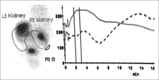 https://cdn.ncbi.nlm.nih.gov/pmc/blobs/a75d/4495501/68b666433030/IJU-31-245-g004.jpg