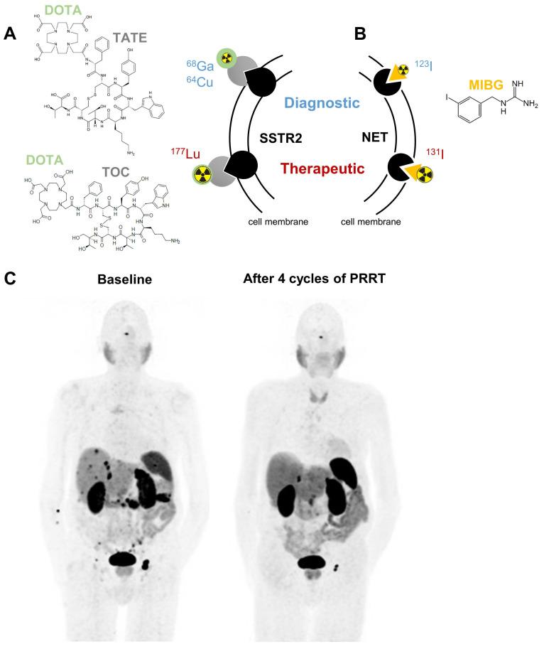 https://cdn.ncbi.nlm.nih.gov/pmc/blobs/a75e/10750207/d3168ff0c97c/thnov14p0017g001.jpg