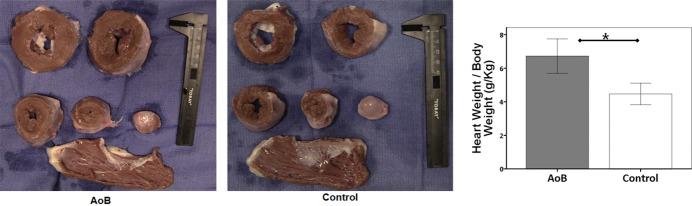 https://cdn.ncbi.nlm.nih.gov/pmc/blobs/a761/4599422/64405dc0bf6f/jah30004-e001925-f3.jpg
