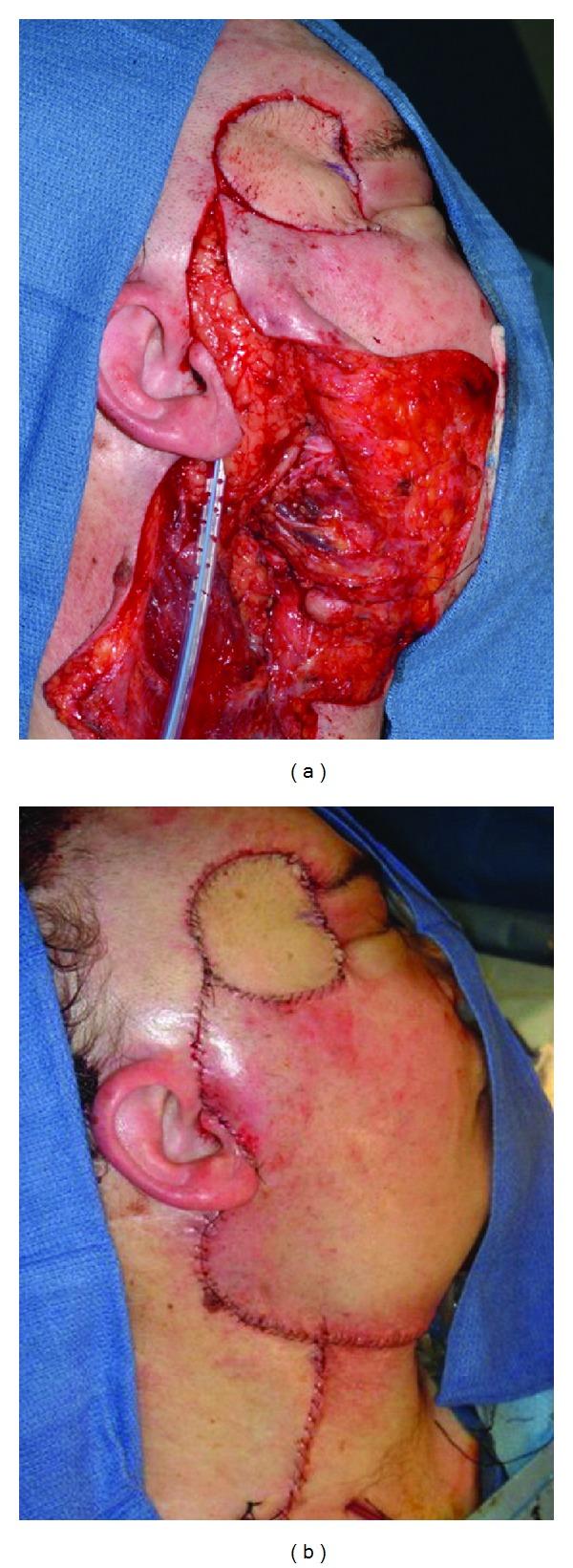 https://cdn.ncbi.nlm.nih.gov/pmc/blobs/a762/3426249/788d528ab1db/JSC2012-742303.004.jpg