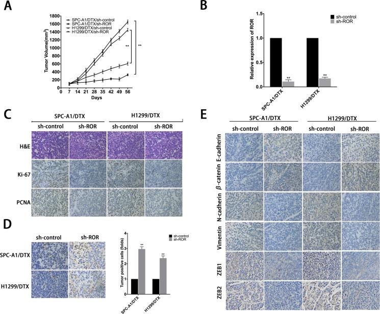 https://cdn.ncbi.nlm.nih.gov/pmc/blobs/a767/5464857/1edee89923e5/oncotarget-08-33144-g003.jpg