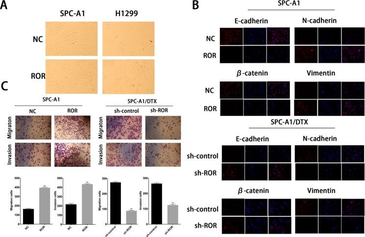 https://cdn.ncbi.nlm.nih.gov/pmc/blobs/a767/5464857/866a78fdfe5f/oncotarget-08-33144-g002.jpg