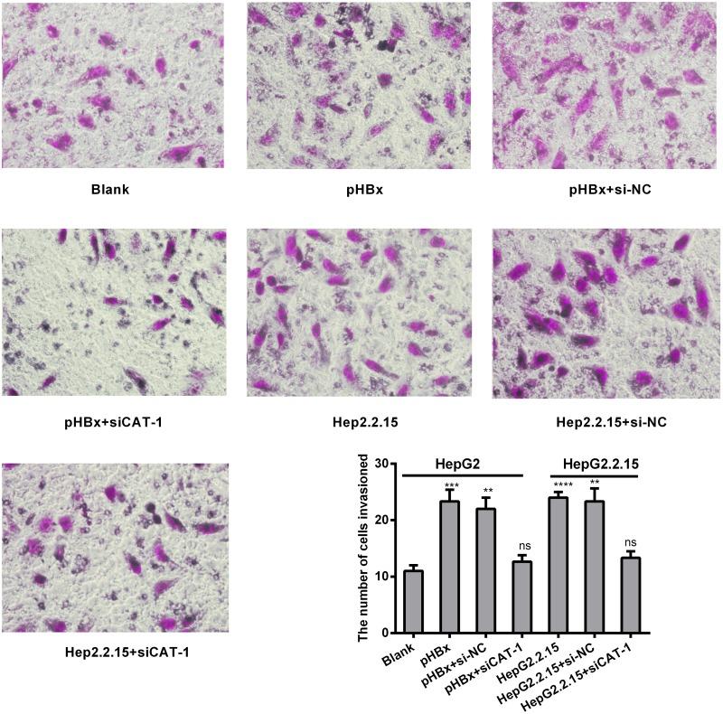 https://cdn.ncbi.nlm.nih.gov/pmc/blobs/a768/5617398/7ca5ba197b82/oncotarget-08-60962-g007.jpg