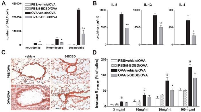 https://cdn.ncbi.nlm.nih.gov/pmc/blobs/a76d/5348320/a405ca44f92b/oncotarget-07-80288-g002.jpg