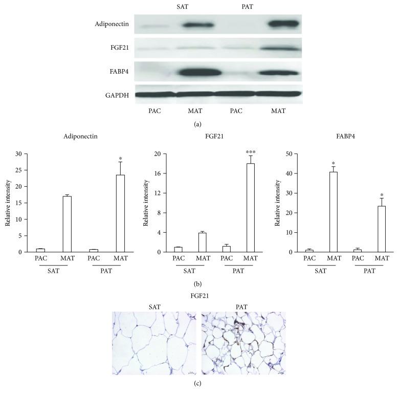 https://cdn.ncbi.nlm.nih.gov/pmc/blobs/a780/5676446/89891a8f1a25/IJE2017-2945012.005.jpg
