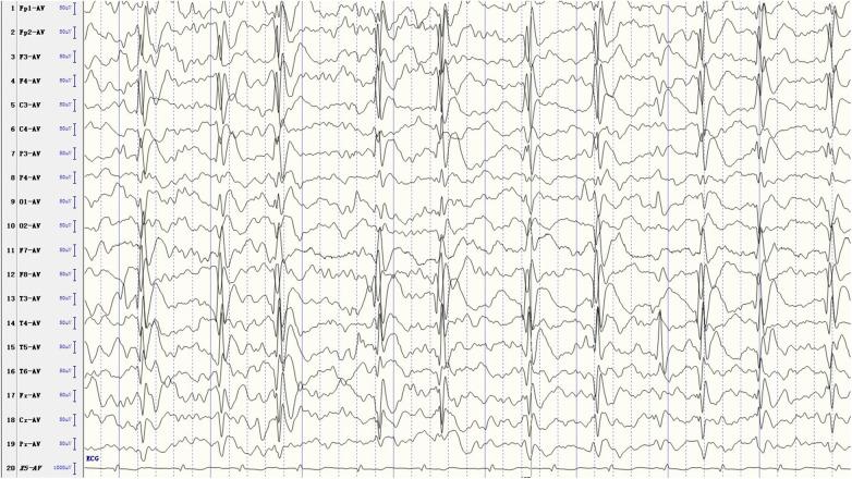 https://cdn.ncbi.nlm.nih.gov/pmc/blobs/a784/11341369/5489d32cad39/fped-12-1388008-g001.jpg