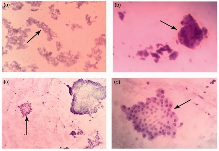 https://cdn.ncbi.nlm.nih.gov/pmc/blobs/a786/6381502/4e6d278ed4c0/10.1177_0300060518807060-fig1.jpg