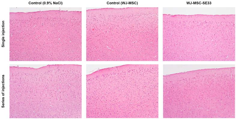 https://cdn.ncbi.nlm.nih.gov/pmc/blobs/a78b/11898551/151976e952f3/cells-14-00341-g005.jpg
