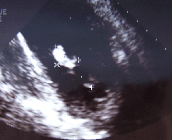 https://cdn.ncbi.nlm.nih.gov/pmc/blobs/a78d/2737767/5bbcbbe1fa22/1752-1947-0003-0000007325-2.jpg