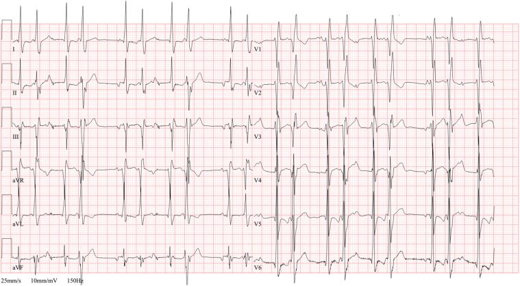 https://cdn.ncbi.nlm.nih.gov/pmc/blobs/a790/8710622/59b59a66d1c6/gr6.jpg