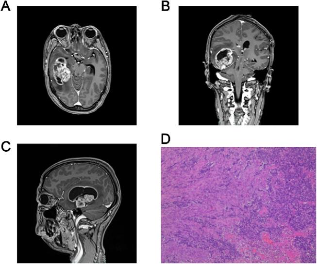 https://cdn.ncbi.nlm.nih.gov/pmc/blobs/a792/11408163/b87048c873f7/fphar-15-1401000-g001.jpg