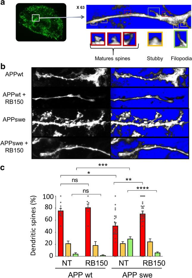 https://cdn.ncbi.nlm.nih.gov/pmc/blobs/a793/8113186/08a6ba3cb2ab/401_2021_2308_Fig2_HTML.jpg