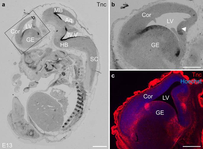 https://cdn.ncbi.nlm.nih.gov/pmc/blobs/a7a1/8526465/d4a7bfdaef25/441_2021_3508_Fig5_HTML.jpg