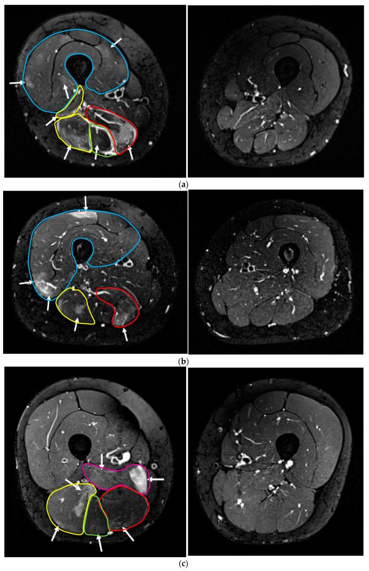https://cdn.ncbi.nlm.nih.gov/pmc/blobs/a7a2/9786230/24b98705b258/sensors-22-10017-g003.jpg
