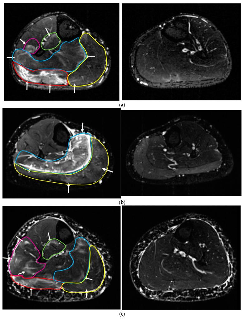 https://cdn.ncbi.nlm.nih.gov/pmc/blobs/a7a2/9786230/a47e5391a9e6/sensors-22-10017-g002.jpg