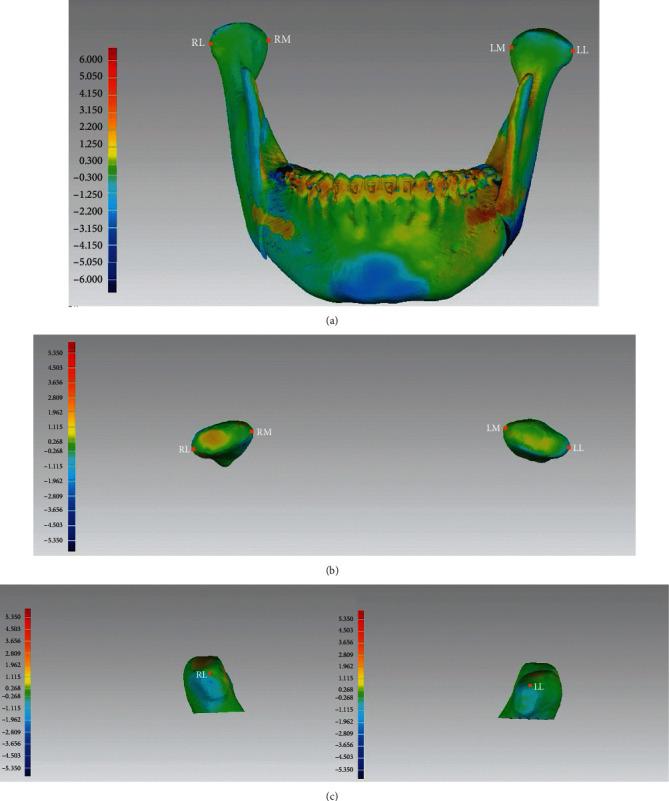 https://cdn.ncbi.nlm.nih.gov/pmc/blobs/a7a4/8367535/cae9ce2ca81c/BMRI2021-1563551.004.jpg