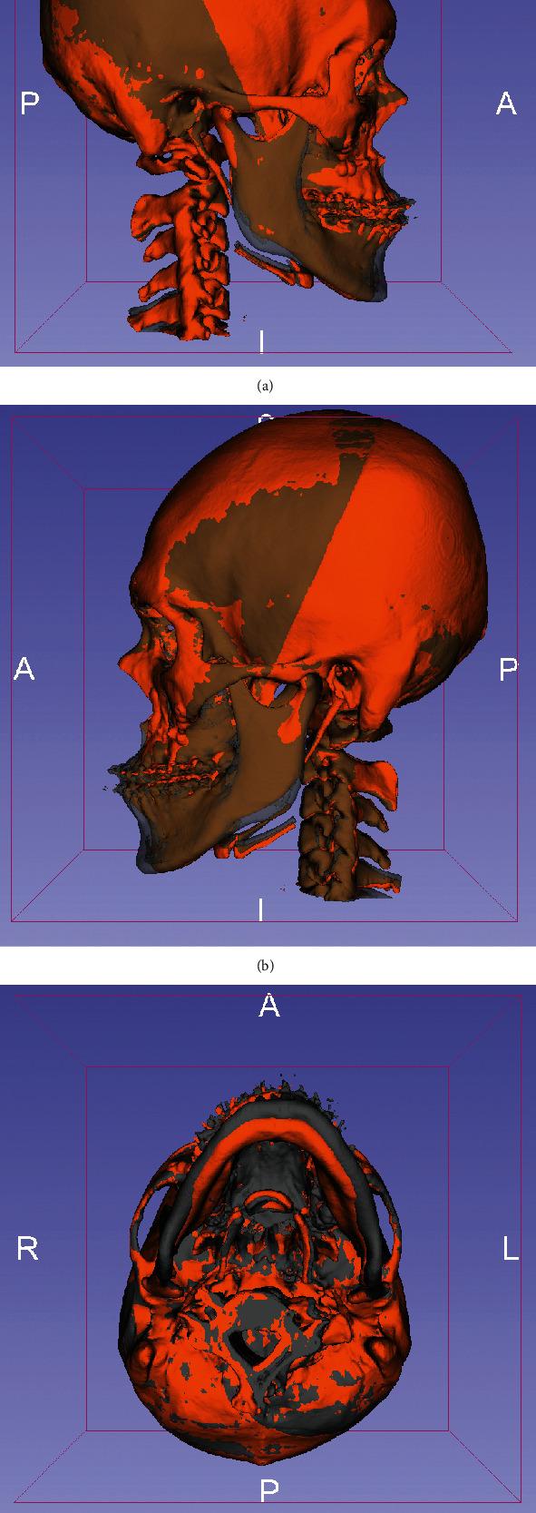 https://cdn.ncbi.nlm.nih.gov/pmc/blobs/a7a4/8367535/f453eef57348/BMRI2021-1563551.001.jpg