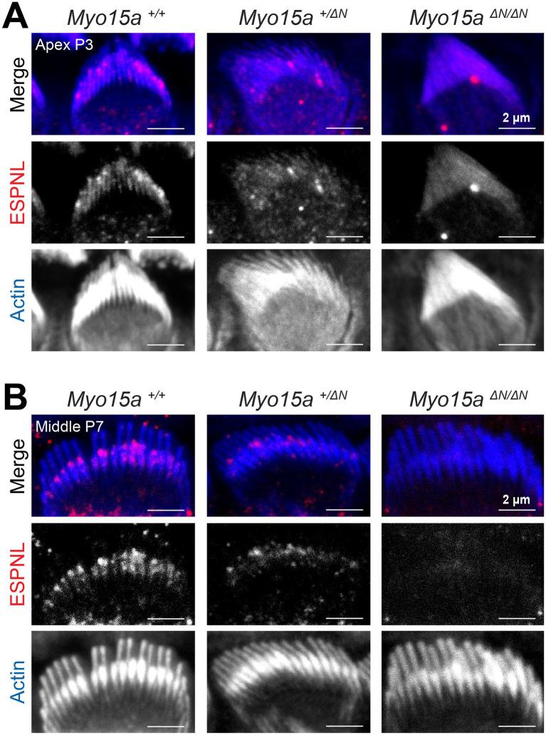 https://cdn.ncbi.nlm.nih.gov/pmc/blobs/a7aa/11704364/0e08ad40a5c7/fneur-15-1482892-g006.jpg