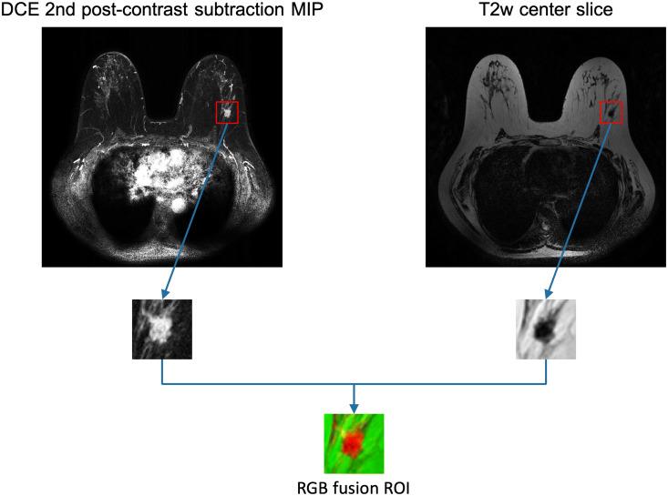 https://cdn.ncbi.nlm.nih.gov/pmc/blobs/a7b1/7324398/1290b7a1b9c9/41598_2020_67441_Fig3_HTML.jpg