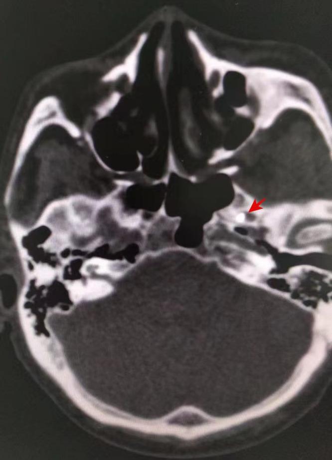 https://cdn.ncbi.nlm.nih.gov/pmc/blobs/a7b3/11316473/71f82655276d/JPR-17-2585-g0001.jpg