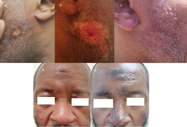 https://cdn.ncbi.nlm.nih.gov/pmc/blobs/a7b5/8641862/cdc7b988d32e/pntd.0009938.g002.jpg