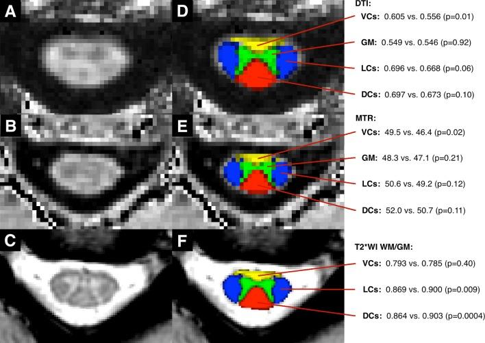 https://cdn.ncbi.nlm.nih.gov/pmc/blobs/a7be/5905727/1a323e2b04a0/bmjopen-2017-019809f05.jpg