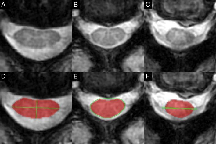 https://cdn.ncbi.nlm.nih.gov/pmc/blobs/a7be/5905727/cd11d15a0f0a/bmjopen-2017-019809f01.jpg