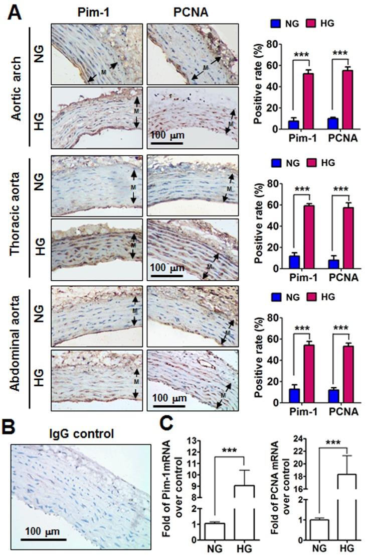 https://cdn.ncbi.nlm.nih.gov/pmc/blobs/a7c2/5687607/b7fa3965f411/oncotarget-08-88320-g001.jpg