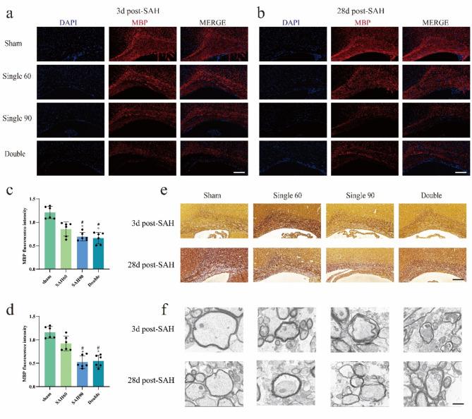 https://cdn.ncbi.nlm.nih.gov/pmc/blobs/a7c3/11685592/52fbfa088910/41598_2024_82843_Fig5_HTML.jpg