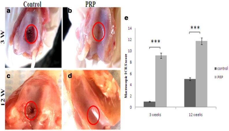 https://cdn.ncbi.nlm.nih.gov/pmc/blobs/a7c5/7998069/03d984d7ae4d/BJR-10-192-g0002.jpg