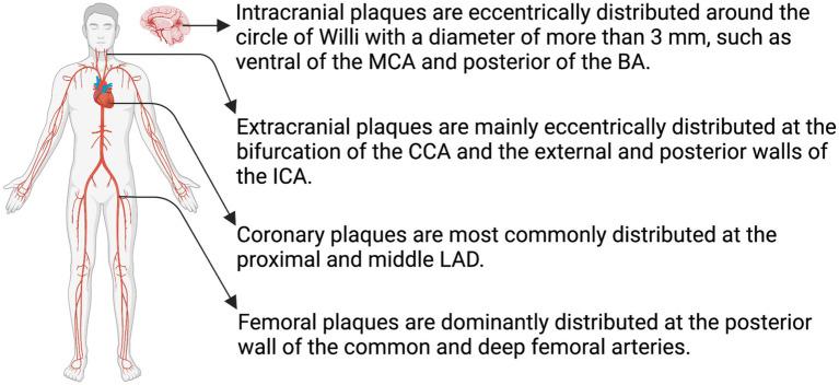 https://cdn.ncbi.nlm.nih.gov/pmc/blobs/a7cc/10603250/c548a58cd98f/fneur-14-1159288-g003.jpg