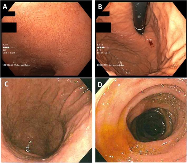 https://cdn.ncbi.nlm.nih.gov/pmc/blobs/a7d7/7197118/7873b0678a5c/12876_2020_1283_Fig2_HTML.jpg