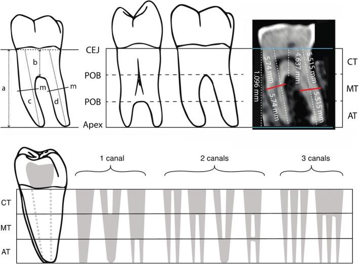 https://cdn.ncbi.nlm.nih.gov/pmc/blobs/a7dc/9482695/9071d0bbd8ce/JOA-241-896-g001.jpg