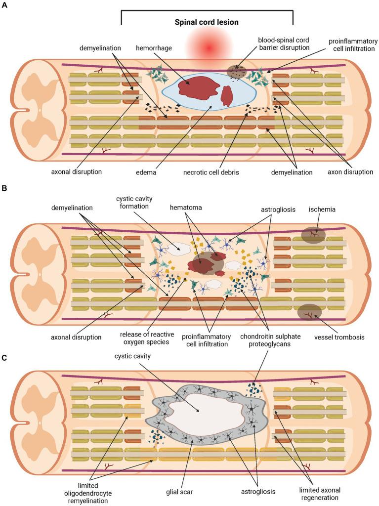 https://cdn.ncbi.nlm.nih.gov/pmc/blobs/a7de/11106386/e529e39e5513/fnins-18-1400413-g001.jpg