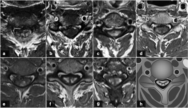 https://cdn.ncbi.nlm.nih.gov/pmc/blobs/a7df/8008469/88c68e54f205/bjrcr.20200133.g003.jpg