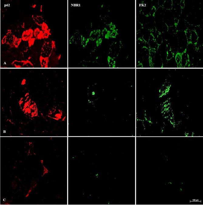 https://cdn.ncbi.nlm.nih.gov/pmc/blobs/a7e0/12102939/694eaaeec0fa/40478_2025_2041_Fig1_HTML.jpg