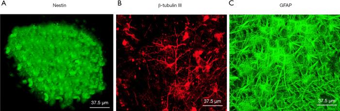 https://cdn.ncbi.nlm.nih.gov/pmc/blobs/a7e0/7475390/985fff6ad0eb/atm-08-15-927-f1.jpg