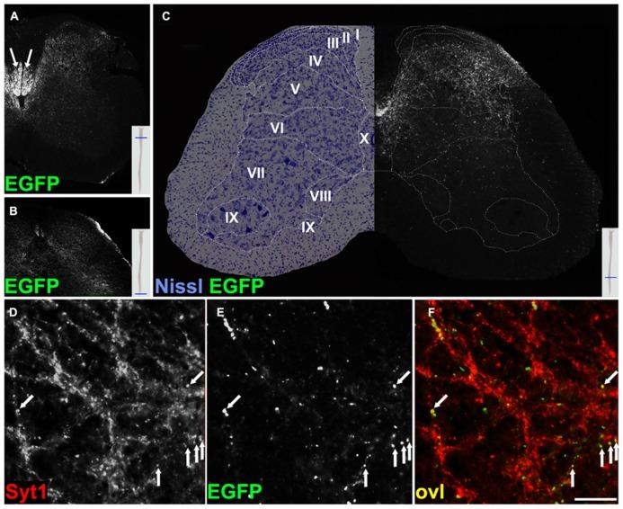 https://cdn.ncbi.nlm.nih.gov/pmc/blobs/a7e1/3882726/fd14534597ce/fnana-07-00050-g005.jpg