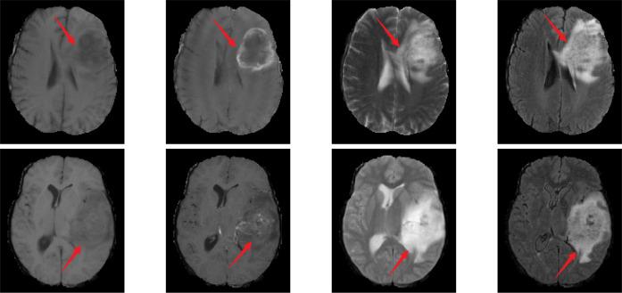 https://cdn.ncbi.nlm.nih.gov/pmc/blobs/a7e2/12127811/6bc6c91e408d/fonc-15-1574861-g001.jpg