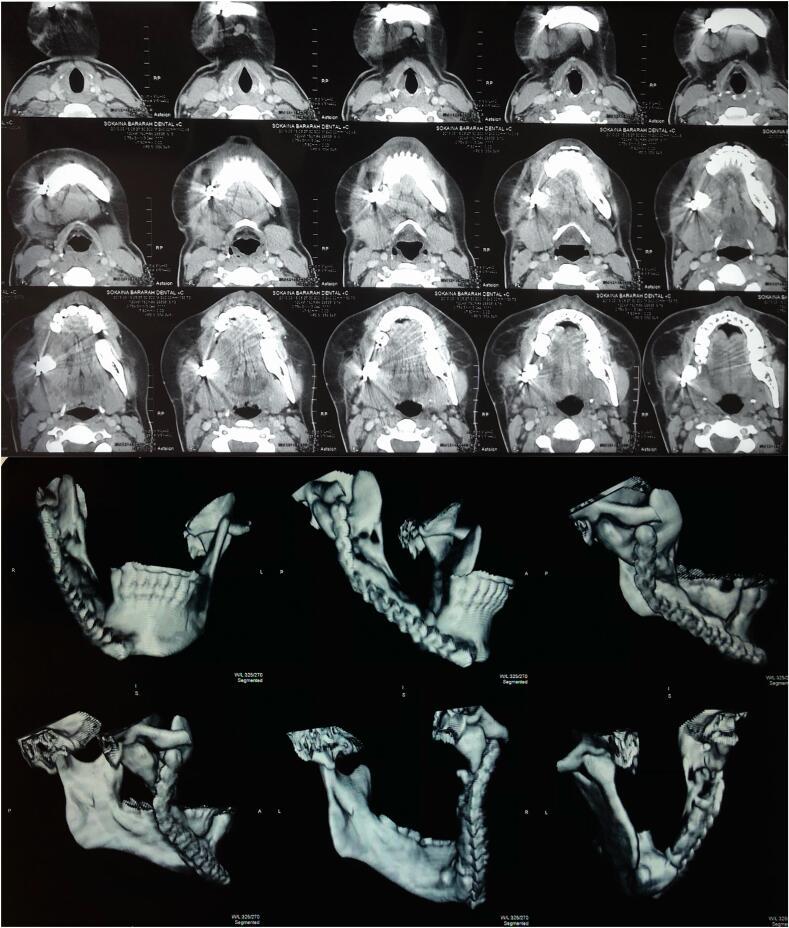 https://cdn.ncbi.nlm.nih.gov/pmc/blobs/a7e8/11177125/28be5605f3ad/gr4.jpg