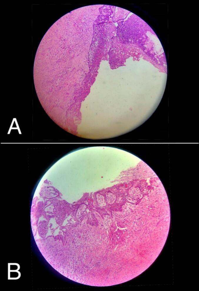 https://cdn.ncbi.nlm.nih.gov/pmc/blobs/a7e8/11177125/737eb1efcaf5/gr2.jpg