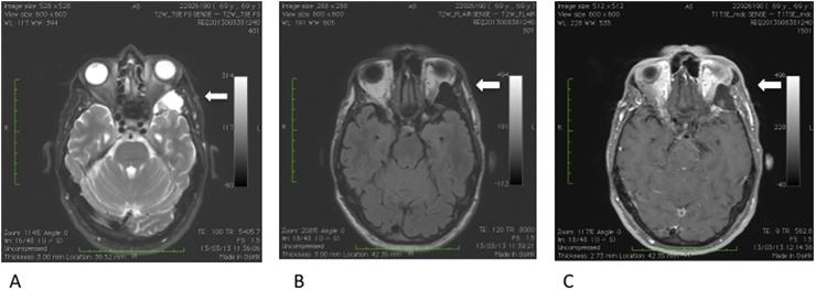 https://cdn.ncbi.nlm.nih.gov/pmc/blobs/a7f1/5508490/4231509364f1/gr1.jpg