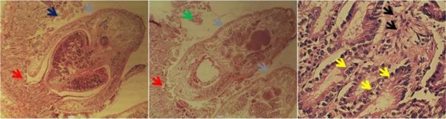 https://cdn.ncbi.nlm.nih.gov/pmc/blobs/a7fe/6243172/6180133c9fd4/IJPA-13-480-g003.jpg