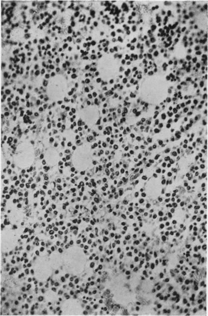 https://cdn.ncbi.nlm.nih.gov/pmc/blobs/a803/480395/98daf4d62866/jclinpath00068-0071-a.jpg