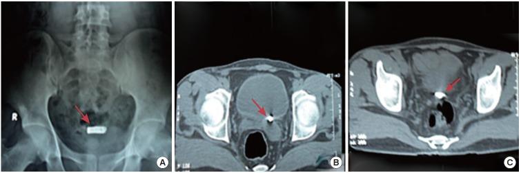 https://cdn.ncbi.nlm.nih.gov/pmc/blobs/a81a/5083828/69546dc2722b/inj-1632524-262f3.jpg