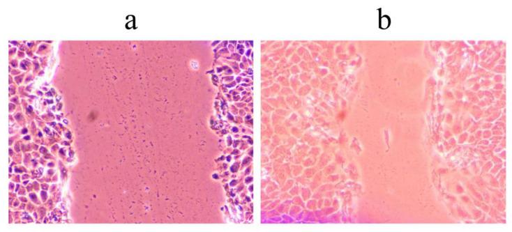 https://cdn.ncbi.nlm.nih.gov/pmc/blobs/a81b/9967942/8cfffc815ea9/pharmaceuticals-16-00245-g003.jpg