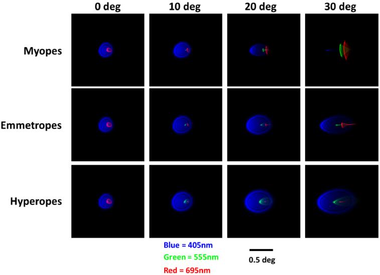 https://cdn.ncbi.nlm.nih.gov/pmc/blobs/a81c/11407258/6e9253946c4a/boe-15-9-5098-g006.jpg